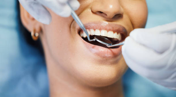 Best Emergency Dental Care for Broken or Chipped Teeth in Rochester, MN